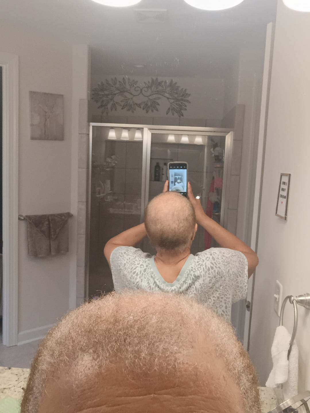 Customer photo review of Rennora EXTRA-Strength Hair Growth Serum