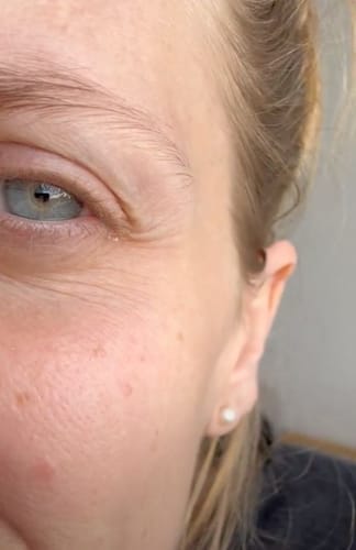 Customer photo review of Multi Collagen Superblend + FREE Gifts (Worth £65)