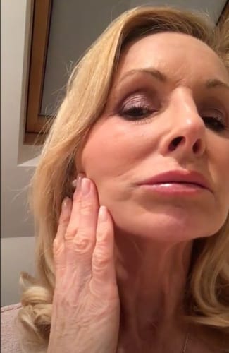 Customer photo review of Multi Collagen Superblend + FREE Gifts (Worth £65)