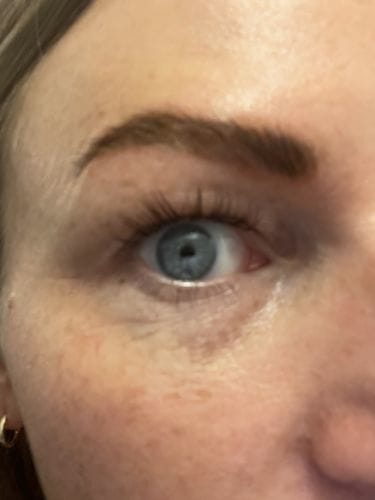 Customer photo review of SimplyLash kit