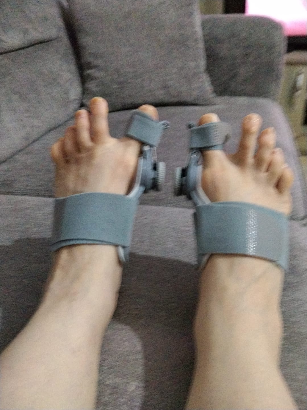 Customer photo review of Foot Medikal™ Ayak Ateli