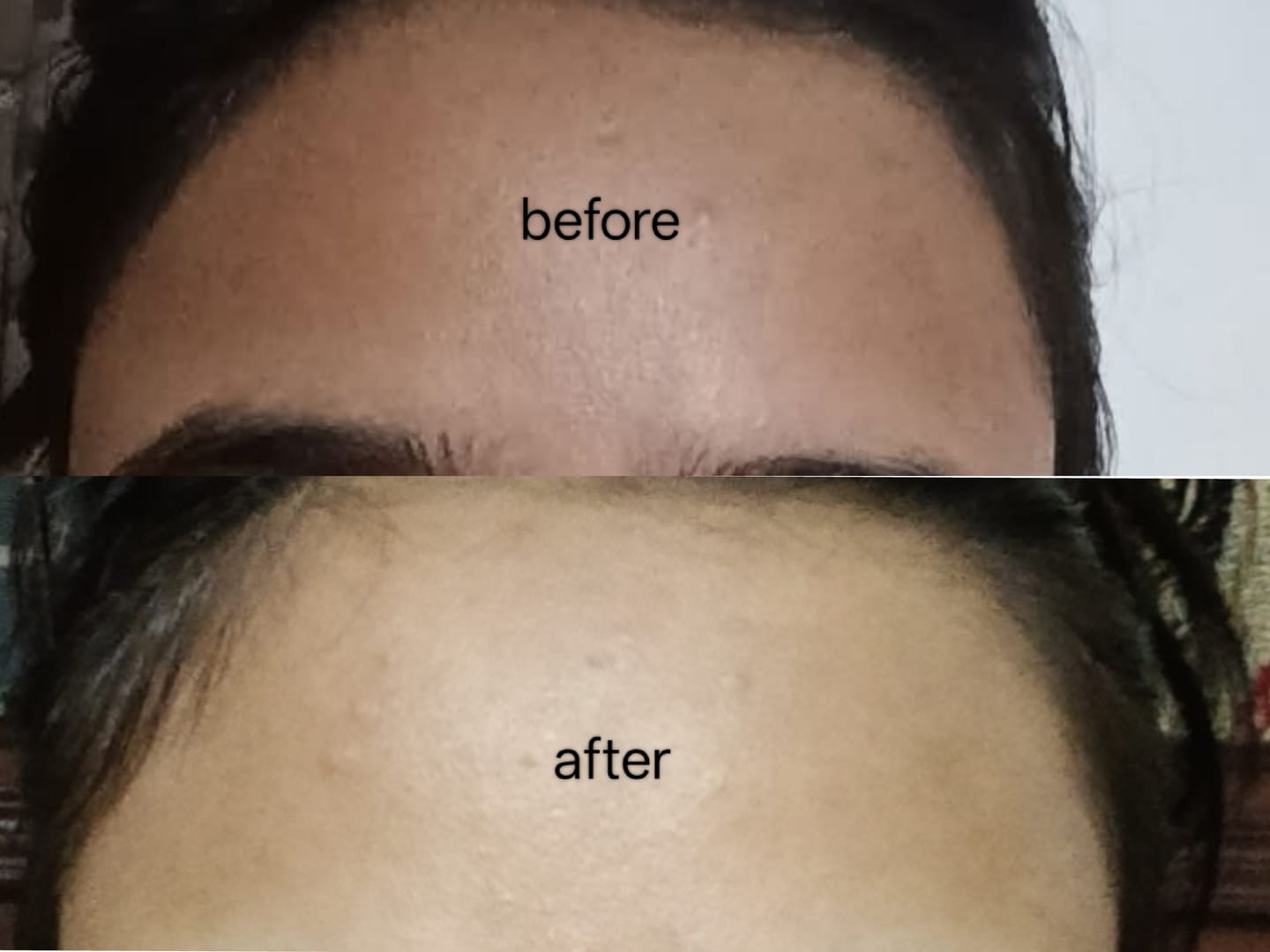 Customer photo review of Maxdif Brightening Serum