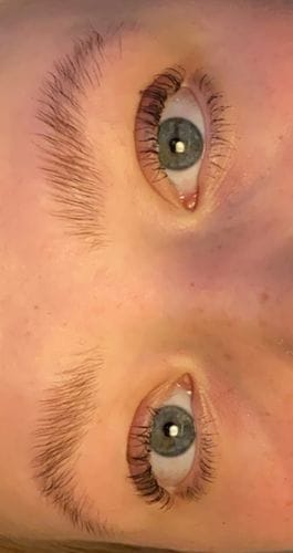 Customer photo review of SimplyLash kit