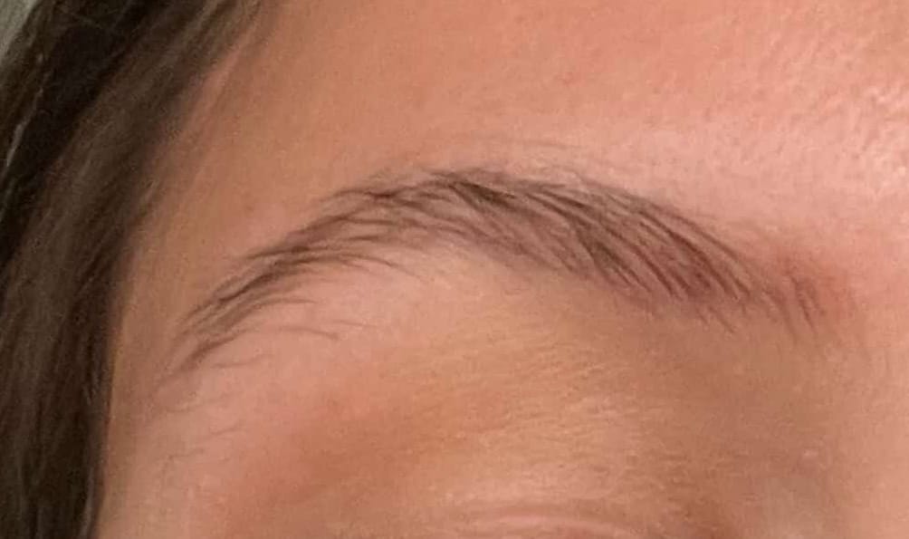 Customer photo review of Eyebrow Growth Roller