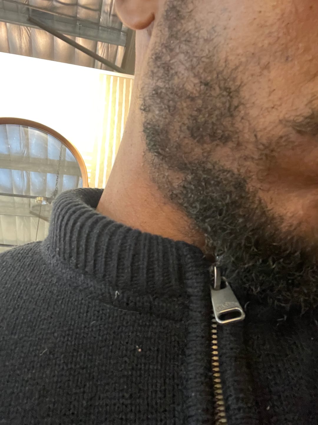 Customer photo review of Minoxidil 5% Solution, 1 x 60ml pack