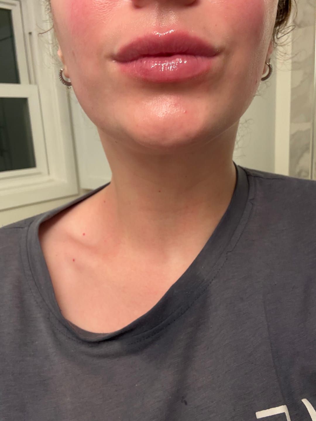 Customer photo review of PDRN Vegan Collagen lip mask Glazed jelly