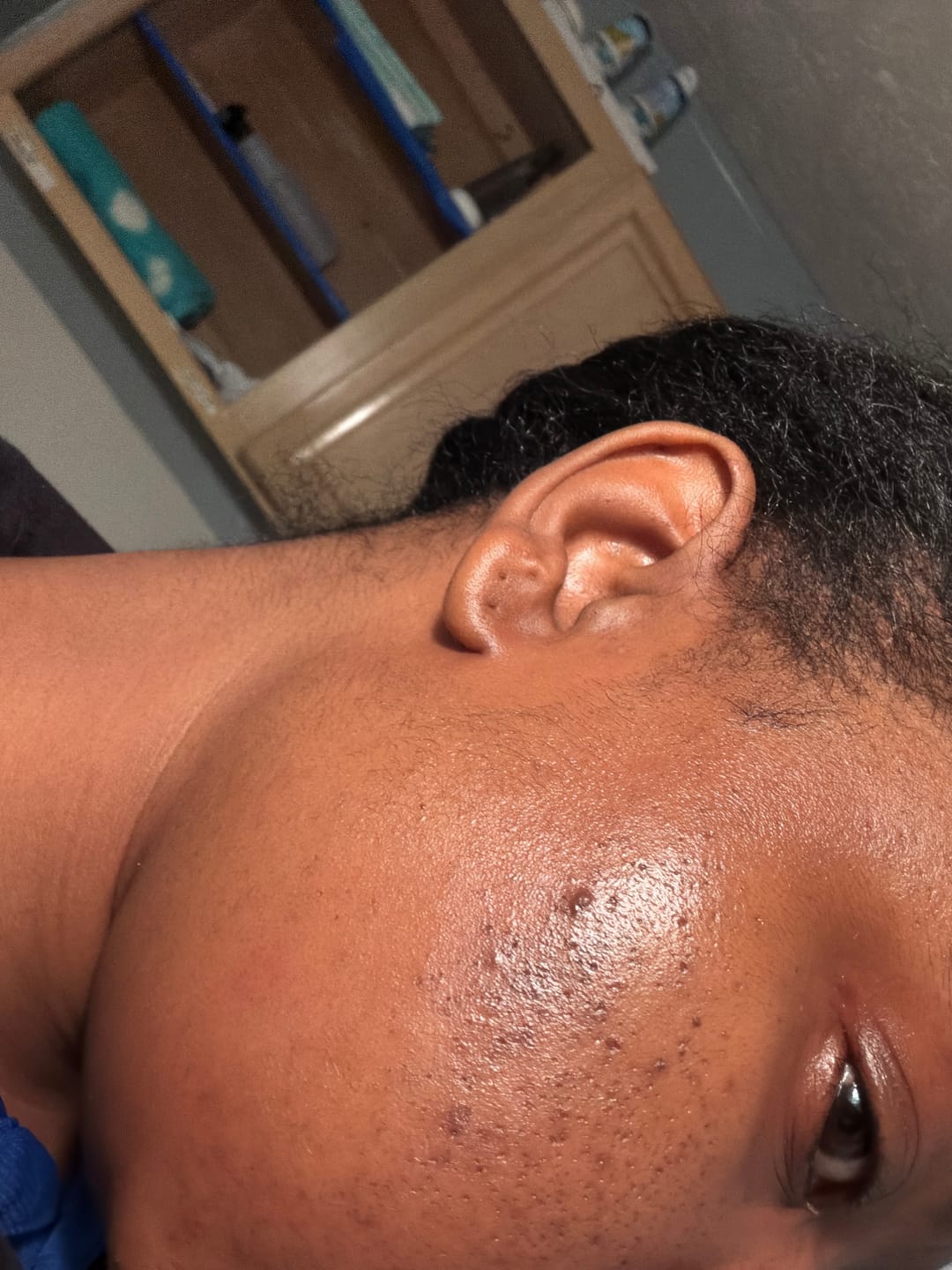 Customer photo review of Organic Turmeric Soap Bar
