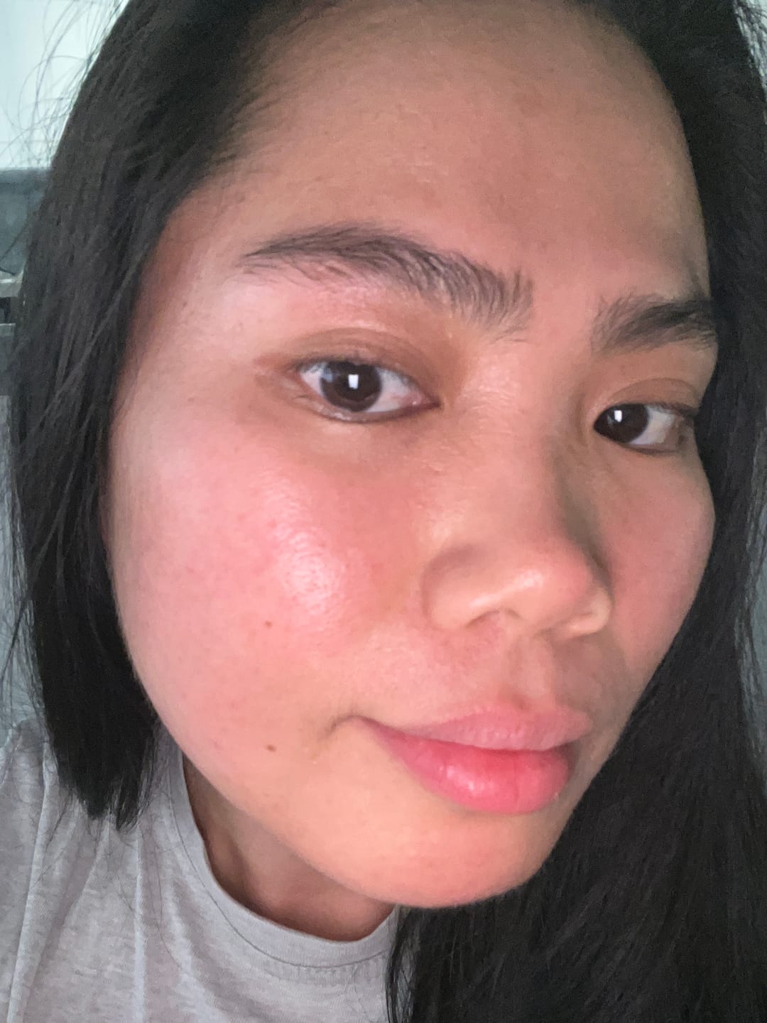 Customer photo review of Dr. Althea - Crème - 345 Relief Cream