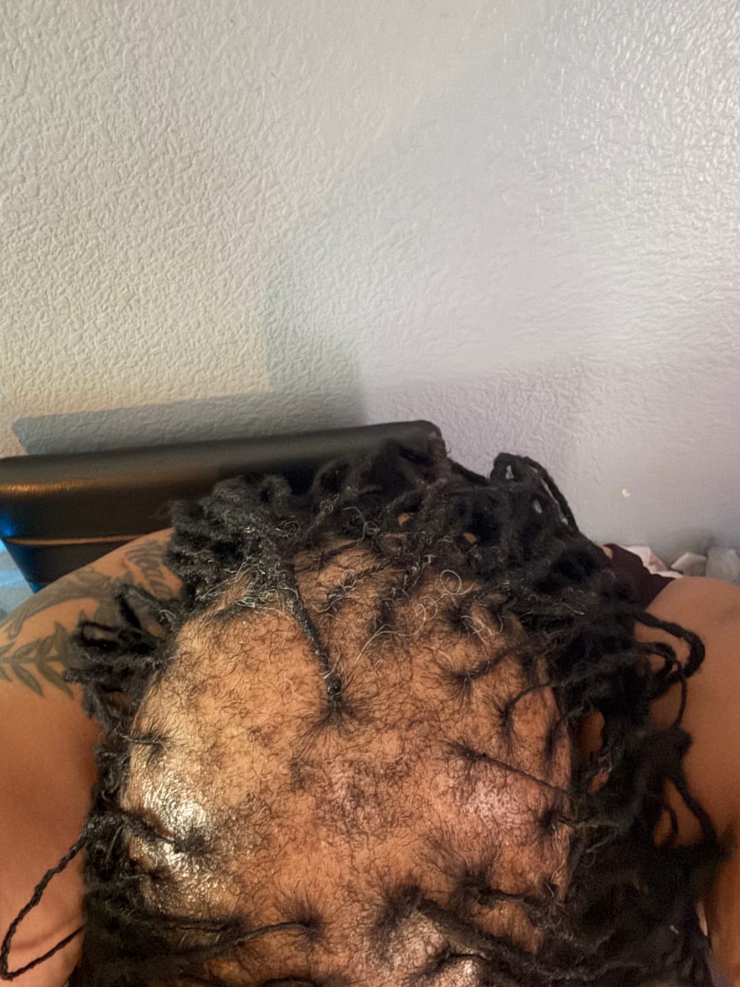 Customer photo review of Rennora Hair Growth Spray