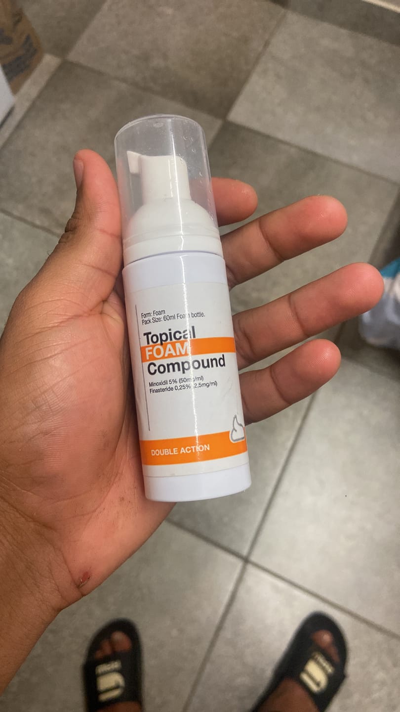 Customer photo review of Minoxidil 5% +DHT Blocker FOAM, MEN ONLY,  3 Month supply