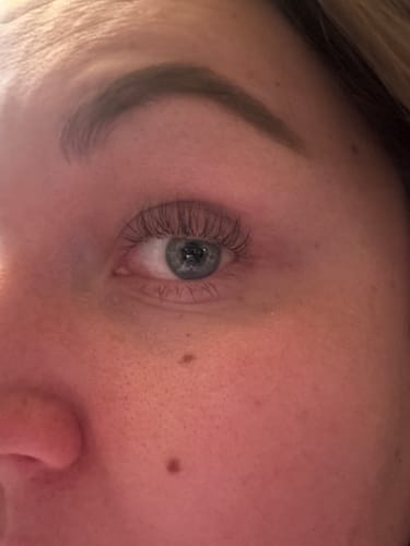 Customer photo review of SimplyLash kit