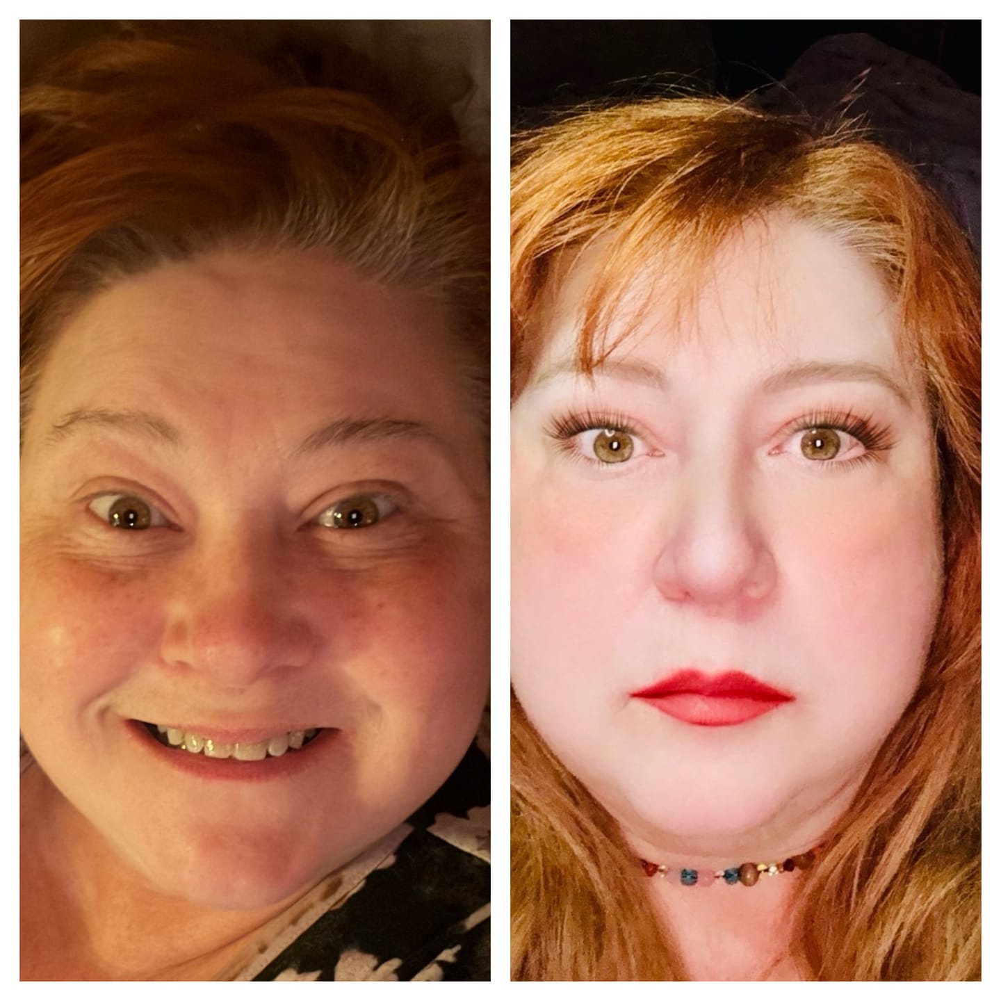 Customer photo review of Anti-Aging treatment