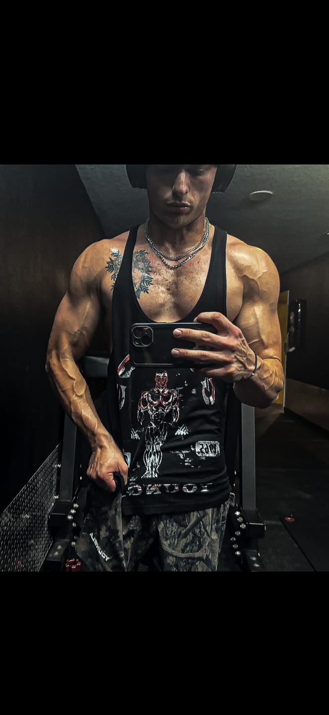 Customer photo review of 3062 - Gold's Glitch Stringers