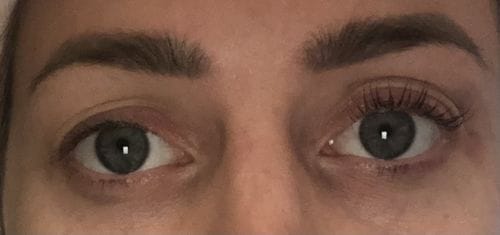 Customer photo review of SimplyLash kit