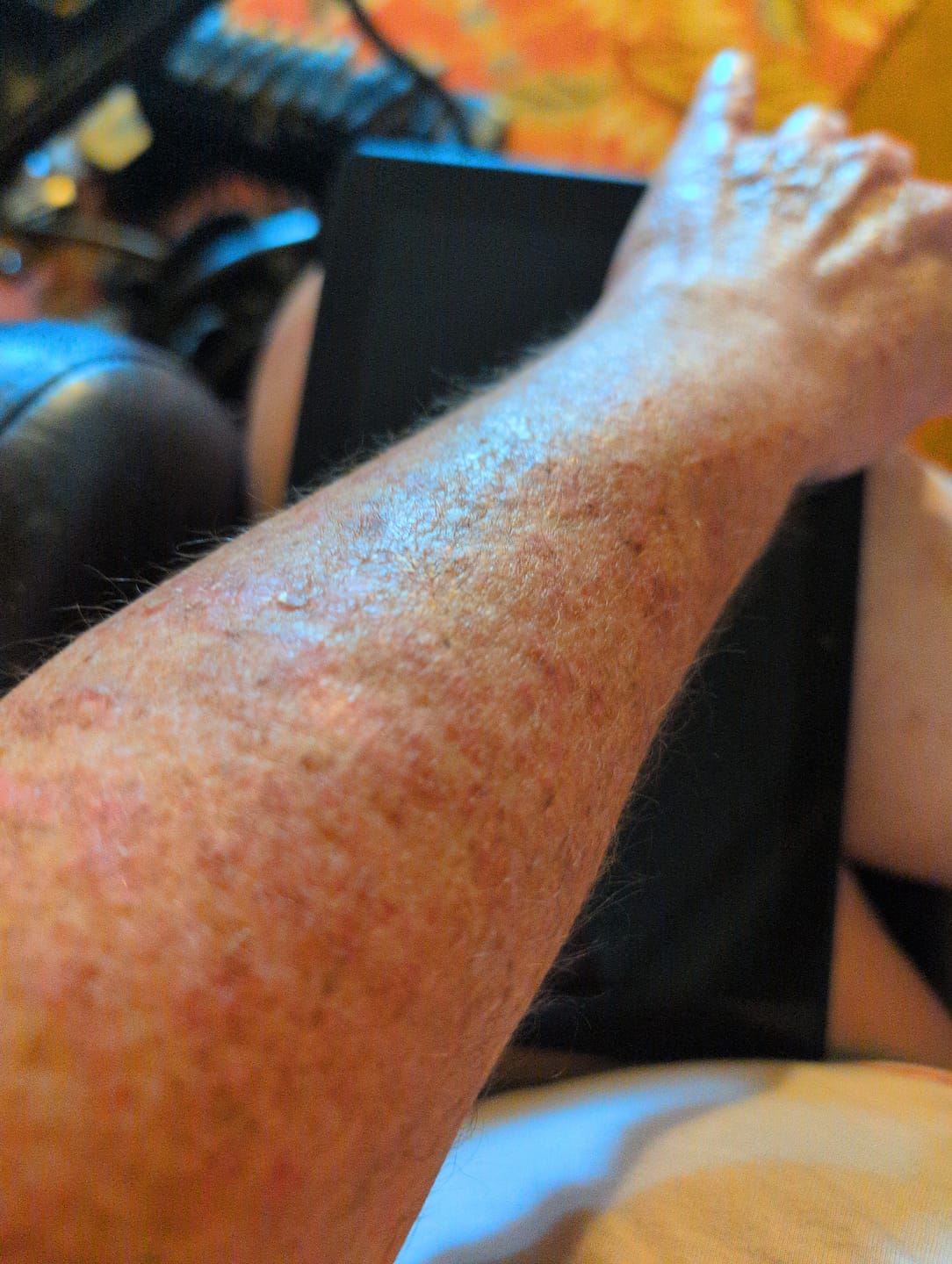 Customer photo review of Chemo Relief Sample Pack Bundle