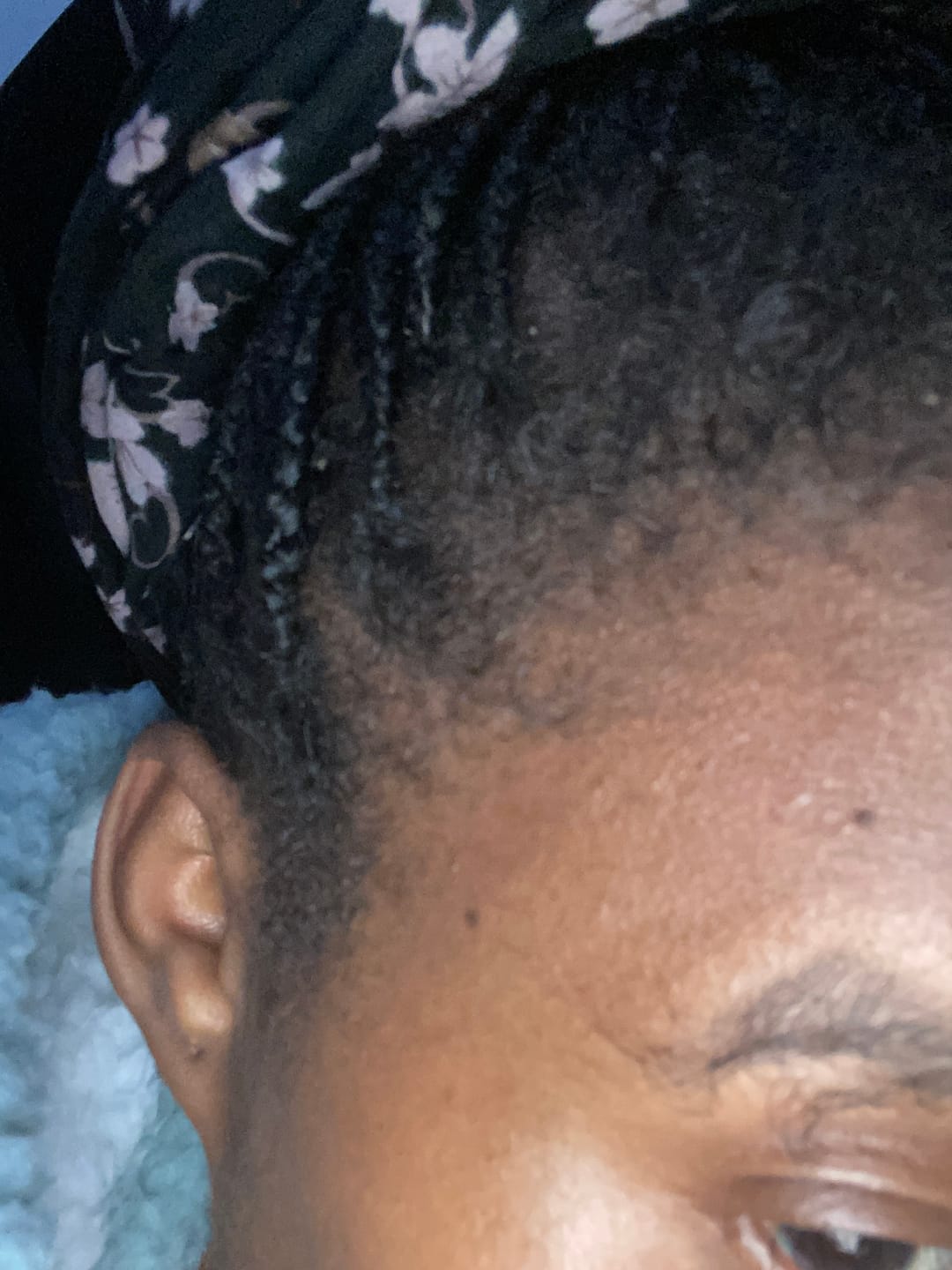 Customer photo review of Minoxidil REGULAR (2%) strength SOLUTION, 1 x 60ml pack