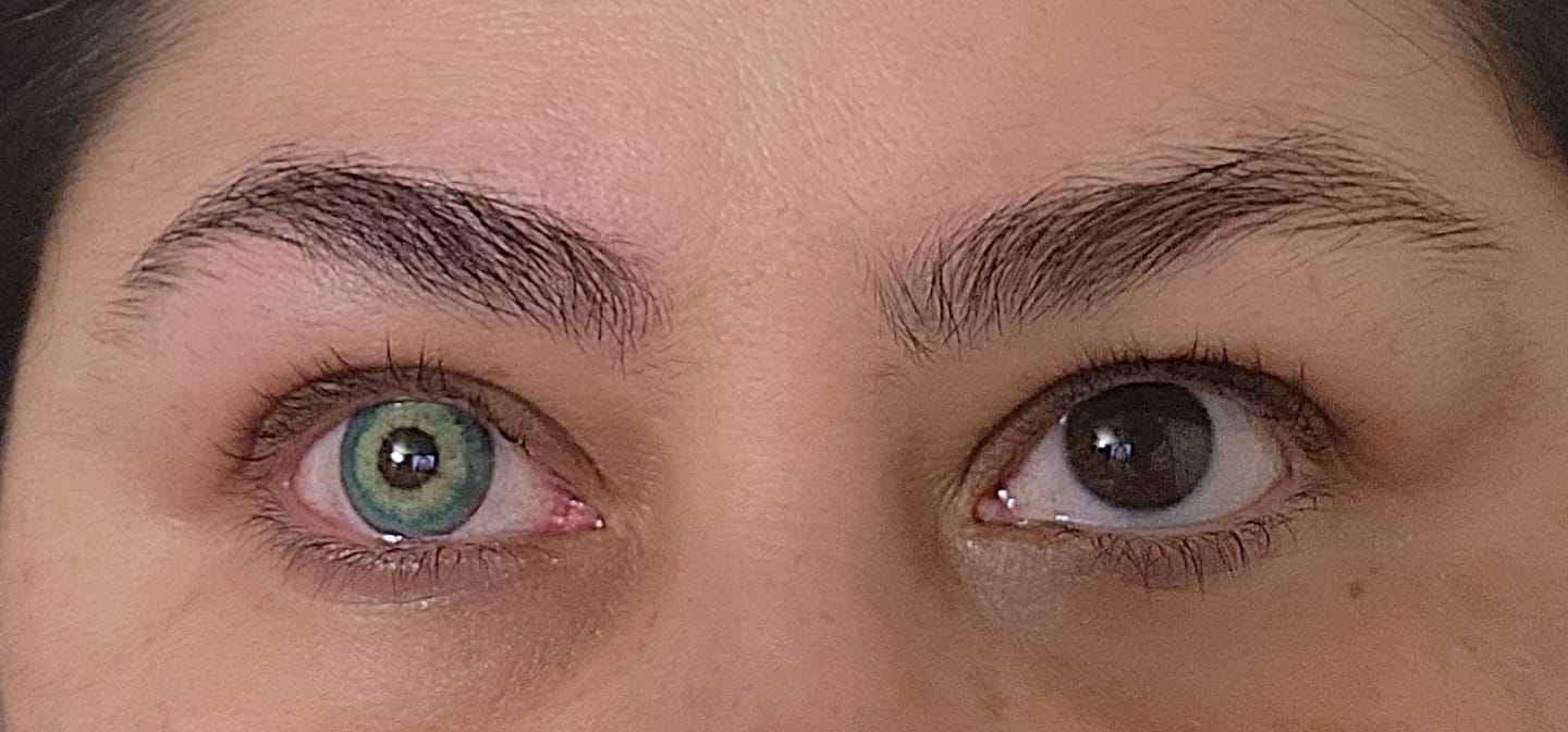 Customer photo review of Himalaya Green Prescription Colored Contact Lenses