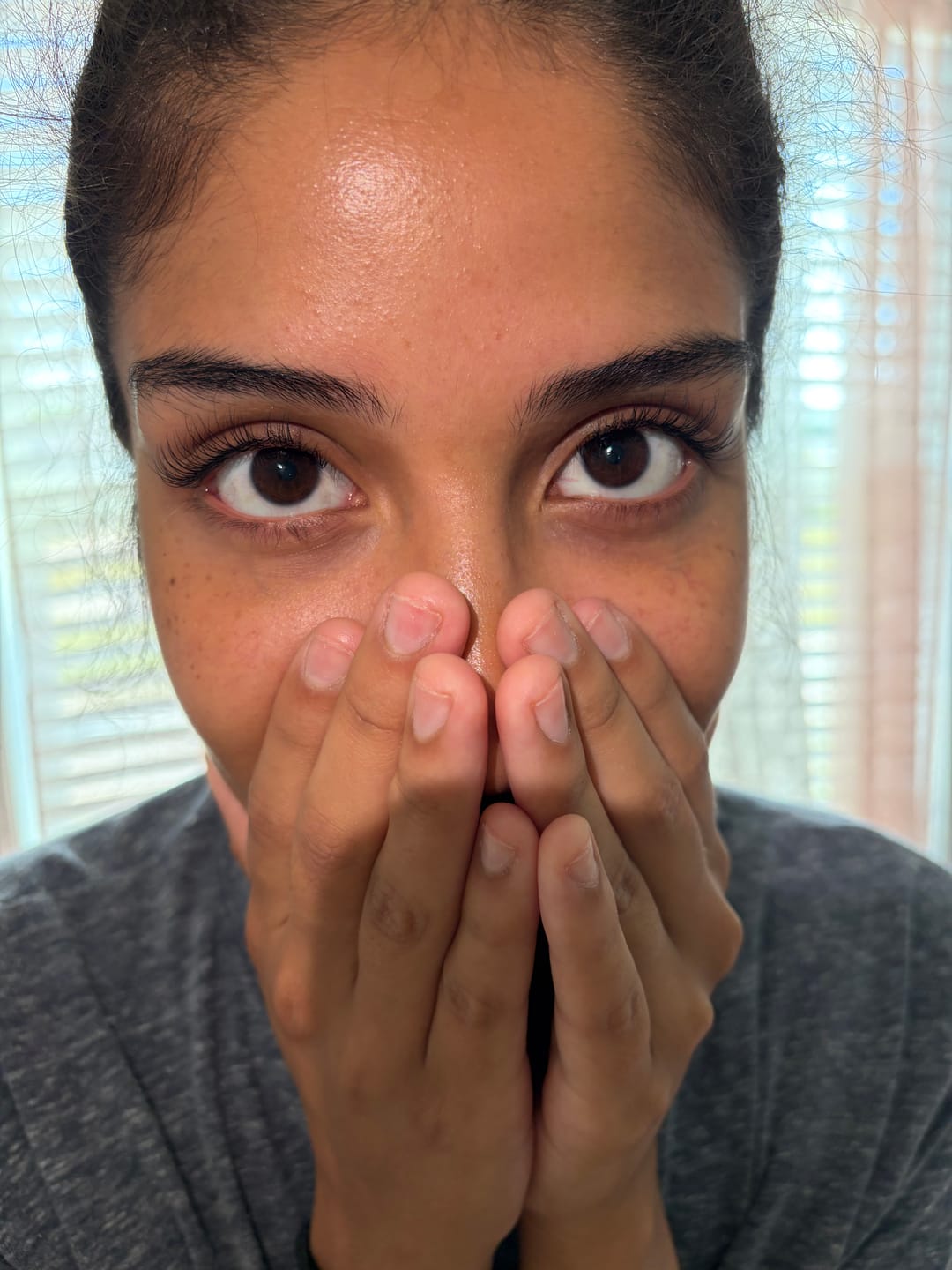Customer photo review of Volume 5ml - Lash Extension Glue