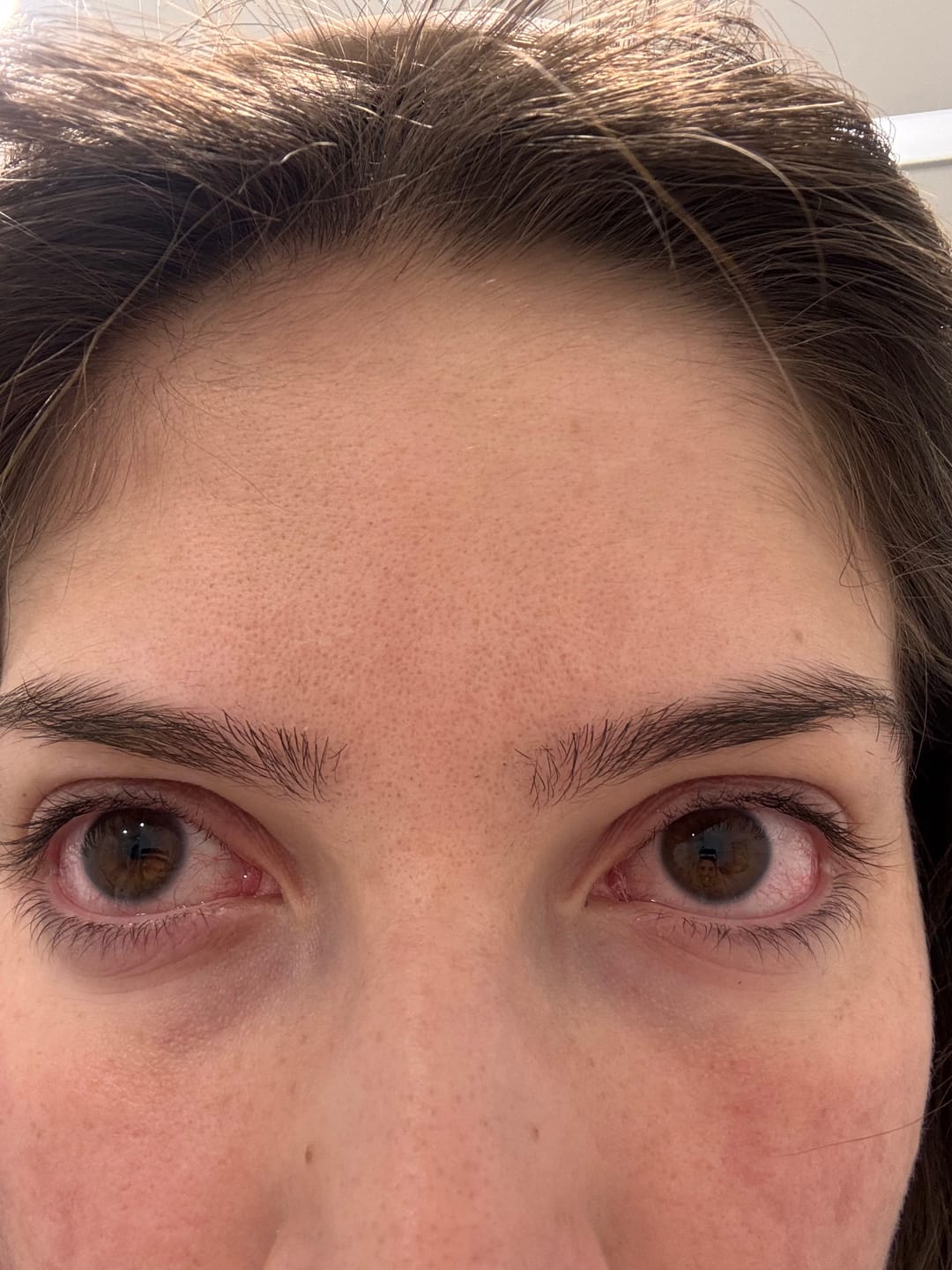 Customer photo review of LASHCOCA!NE - Wimpernserum