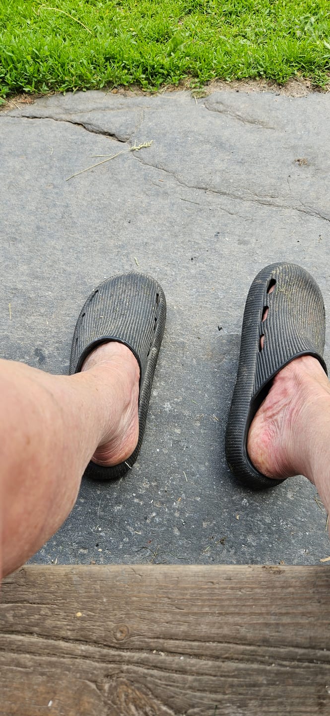 Customer photo review of HappyClogs Strapless