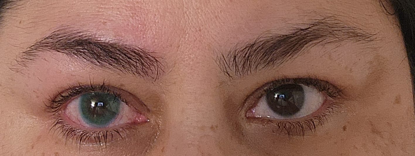 Customer photo review of Polar Light Blue Prescription Colored Contact Lenses