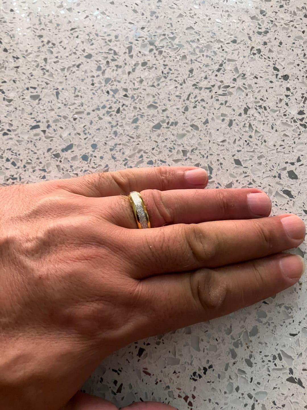 Customer photo review of The Golden Steel Wonder Ring Set