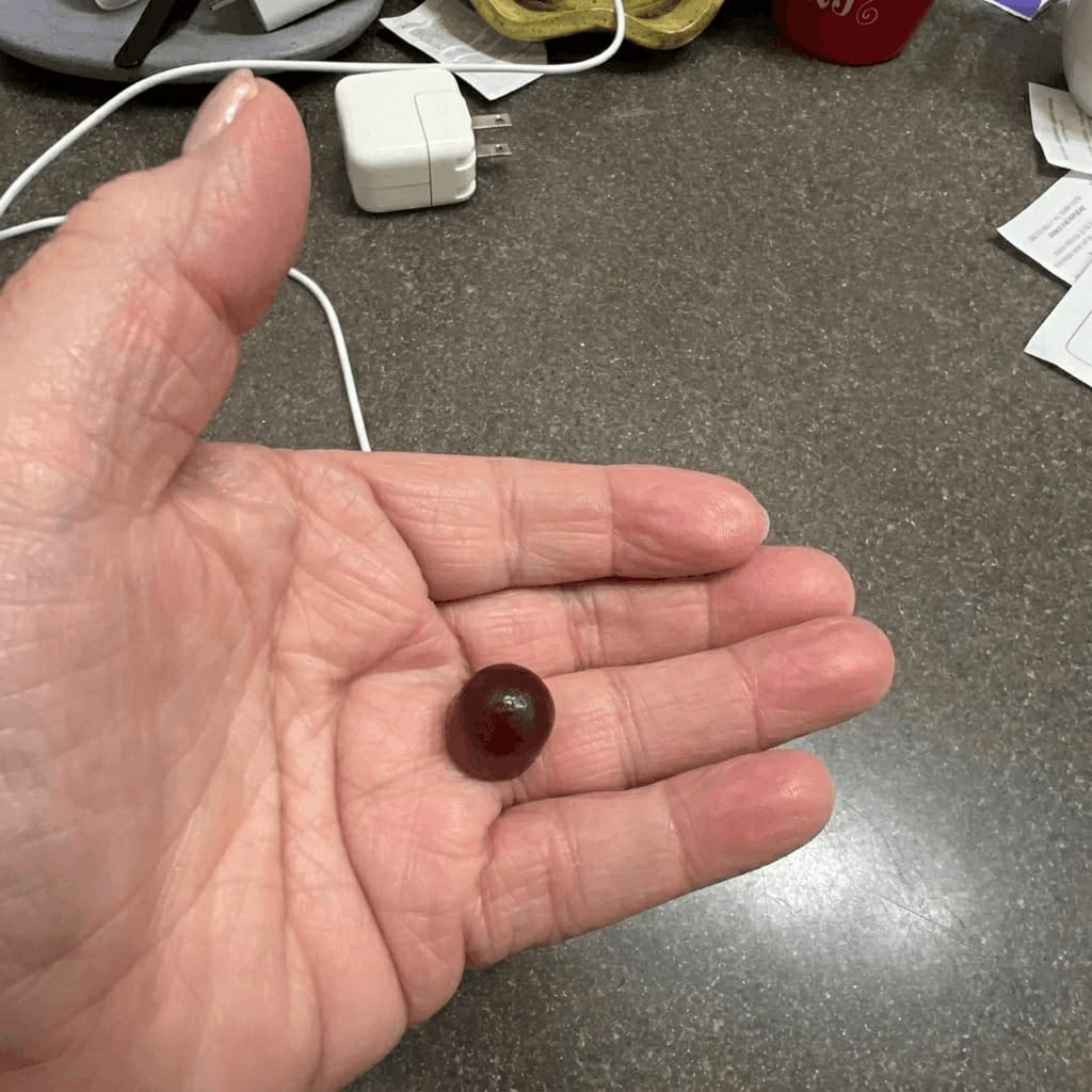 Customer photo review of WonderSleep Gummies