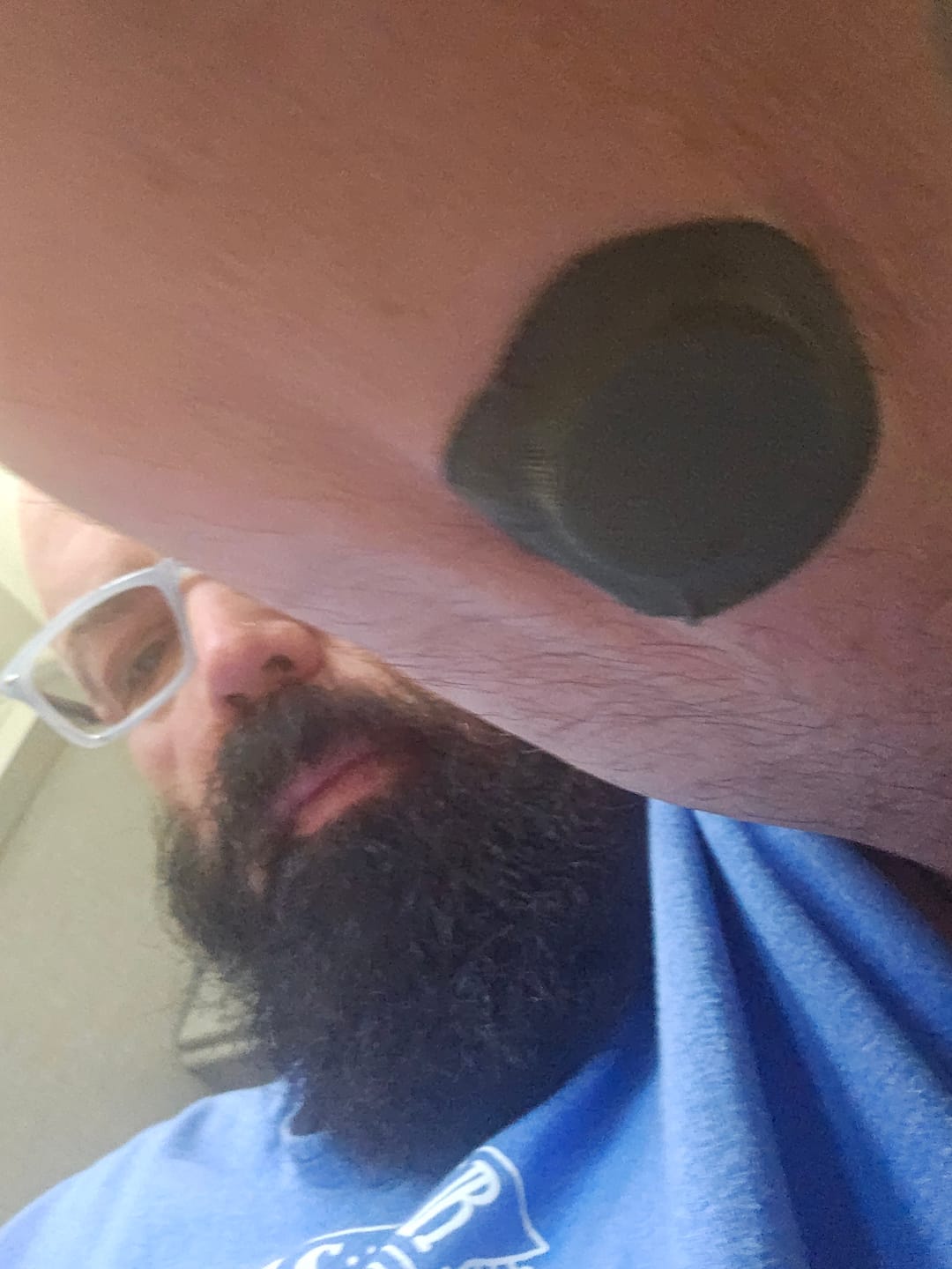 Customer photo review of Skin Grip Original - Instinct Adhesive Patches