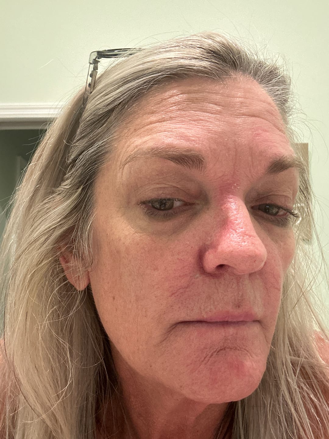 Customer photo review of Glov Micro Infusion System