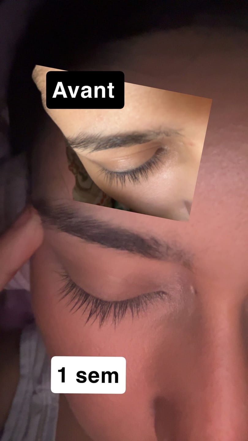 Customer photo review of SÉRUM DE CROISSANCE POUR CILS
