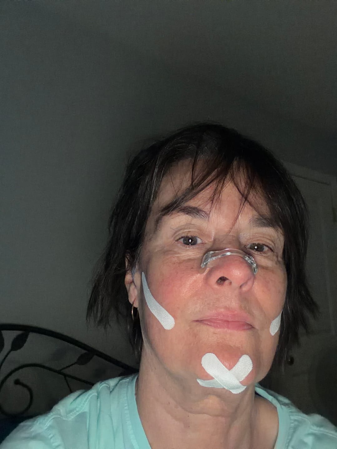 Customer photo review of Zygo Tape - Facial Sculpting & Anti-Aging Tape For Women