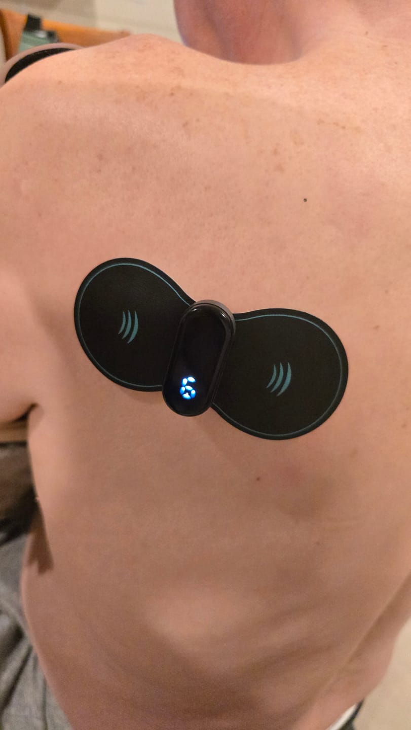 Customer photo review of Vibit PULSE - Wireless Electrical Muscle Stimulator