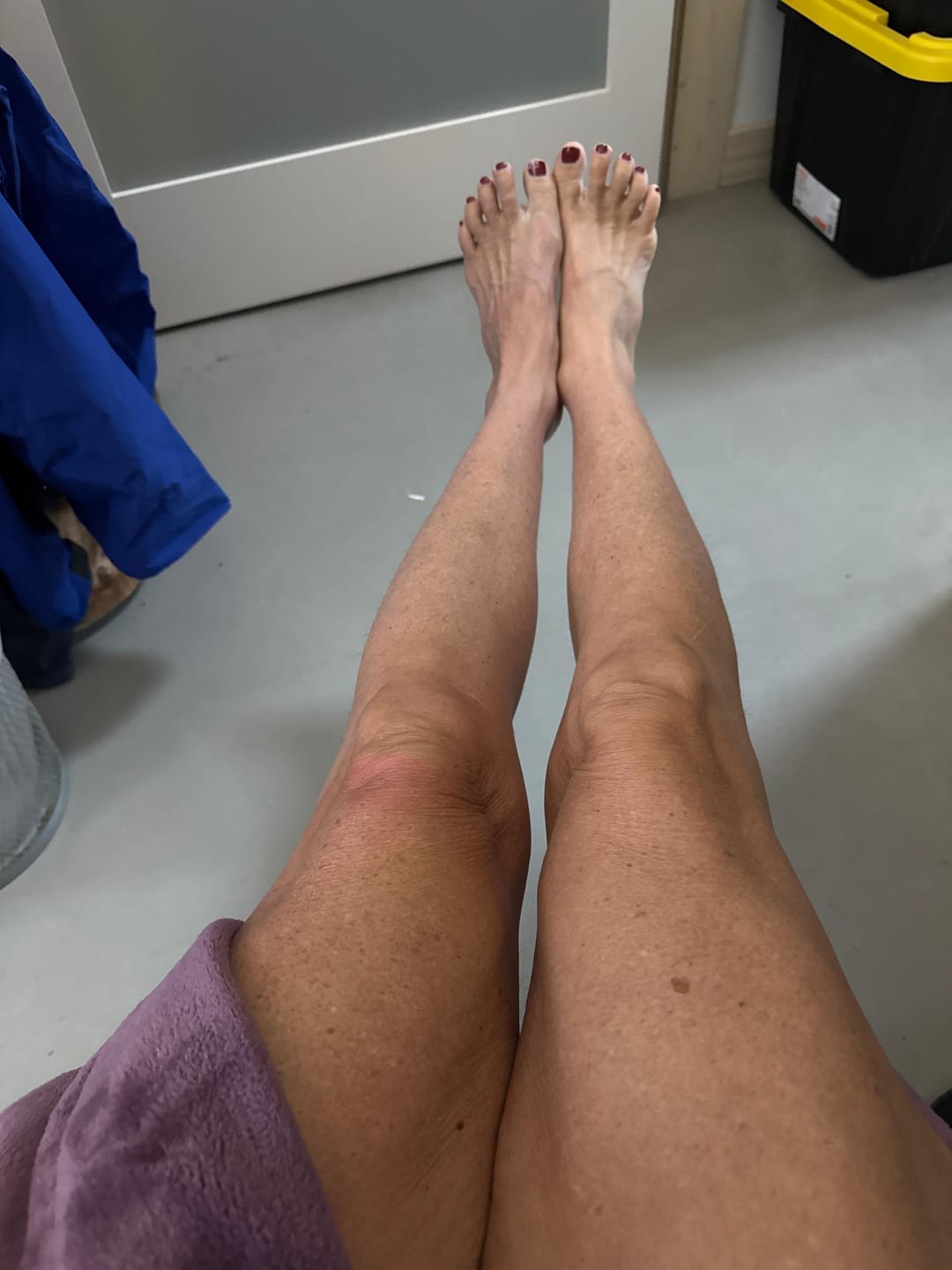 Customer photo review of Restorative Body Cream