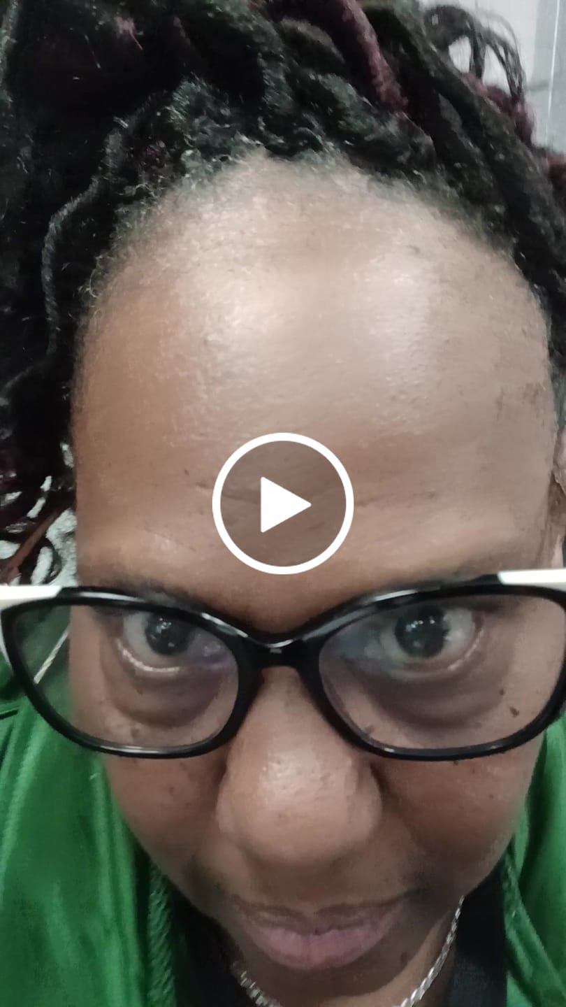 Customer video review of Rennora Hair Growth Serum