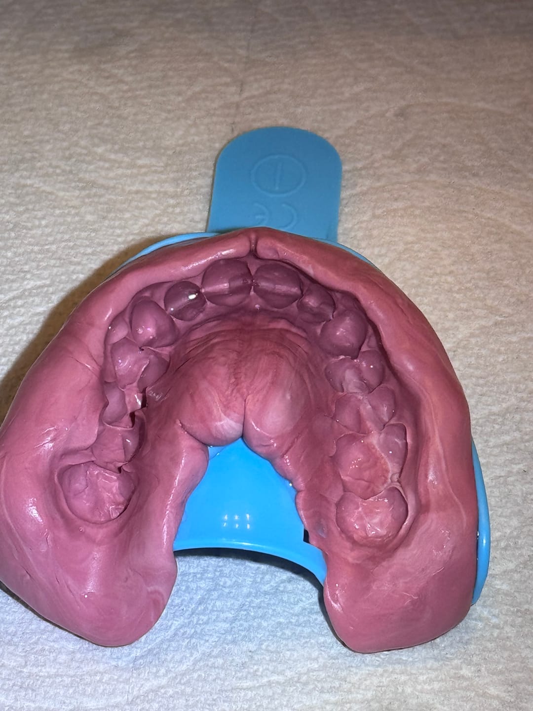 Customer photo review of Extra Impression Putty (STRONGLY RECOMMENDED)