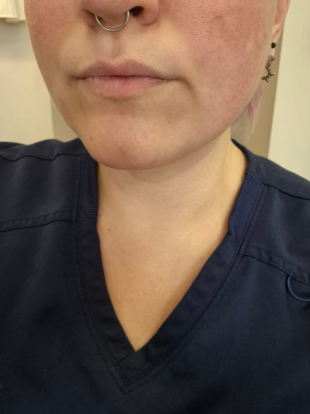 Customer photo review of Nomierinošs krēms ar resveratrolu Dr. Althea 345 Relief Cream