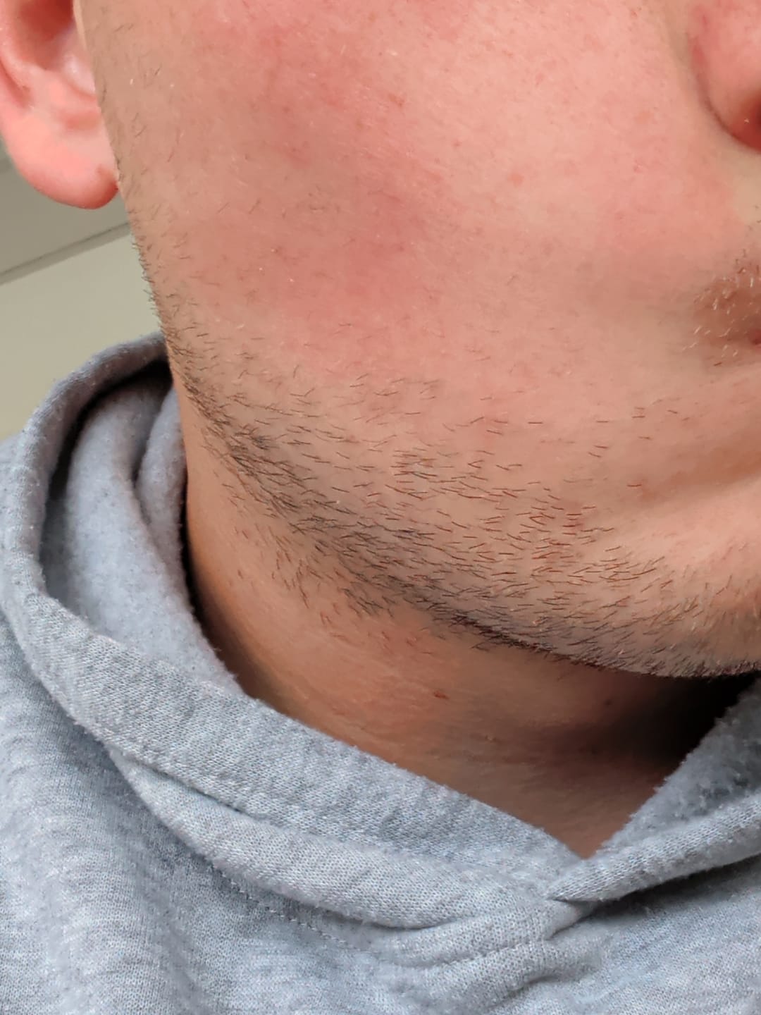 Customer photo review of Coffret Viking | Kit Professionnel Pousse Barbe