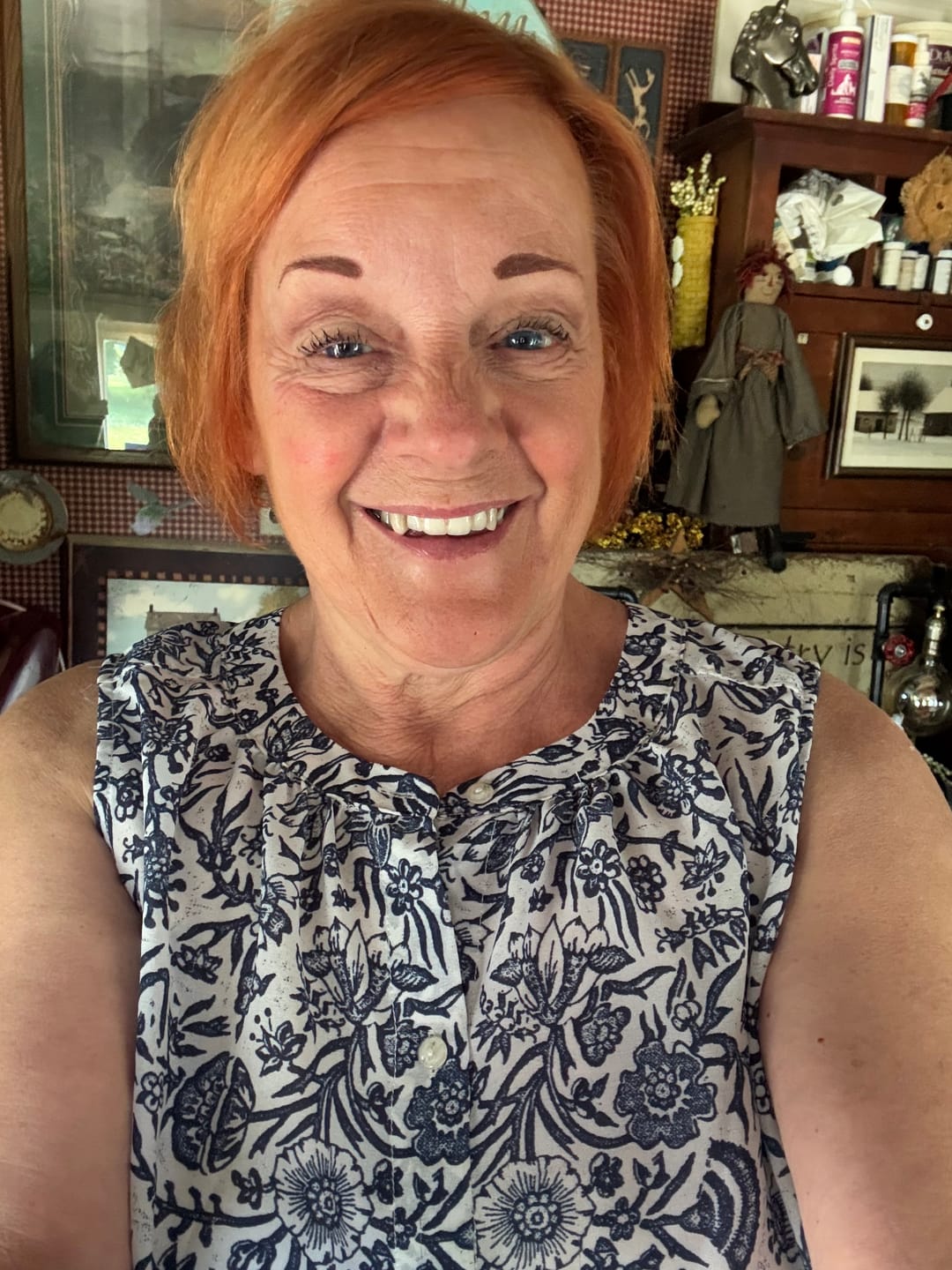 Customer photo review of Eyeling Custom Lens – 1 Month