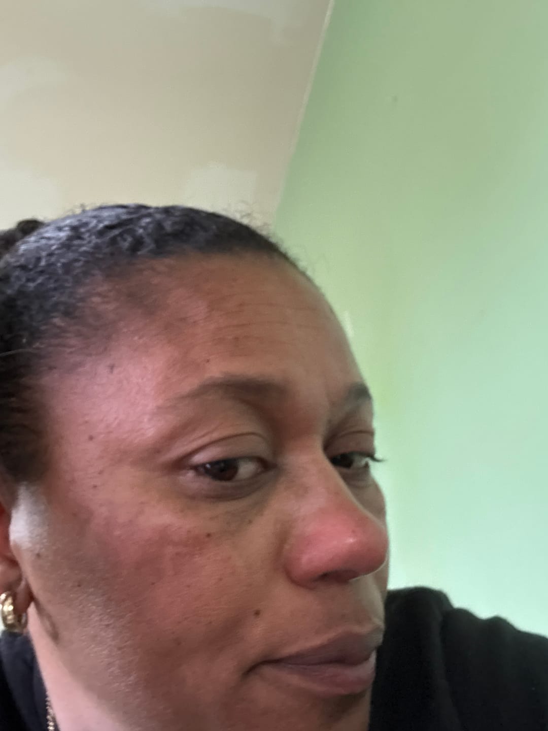 Customer photo review of LightenUp Plus Papaya Bathing Bar With Shea Butter 80g / 2.82 fl oz
