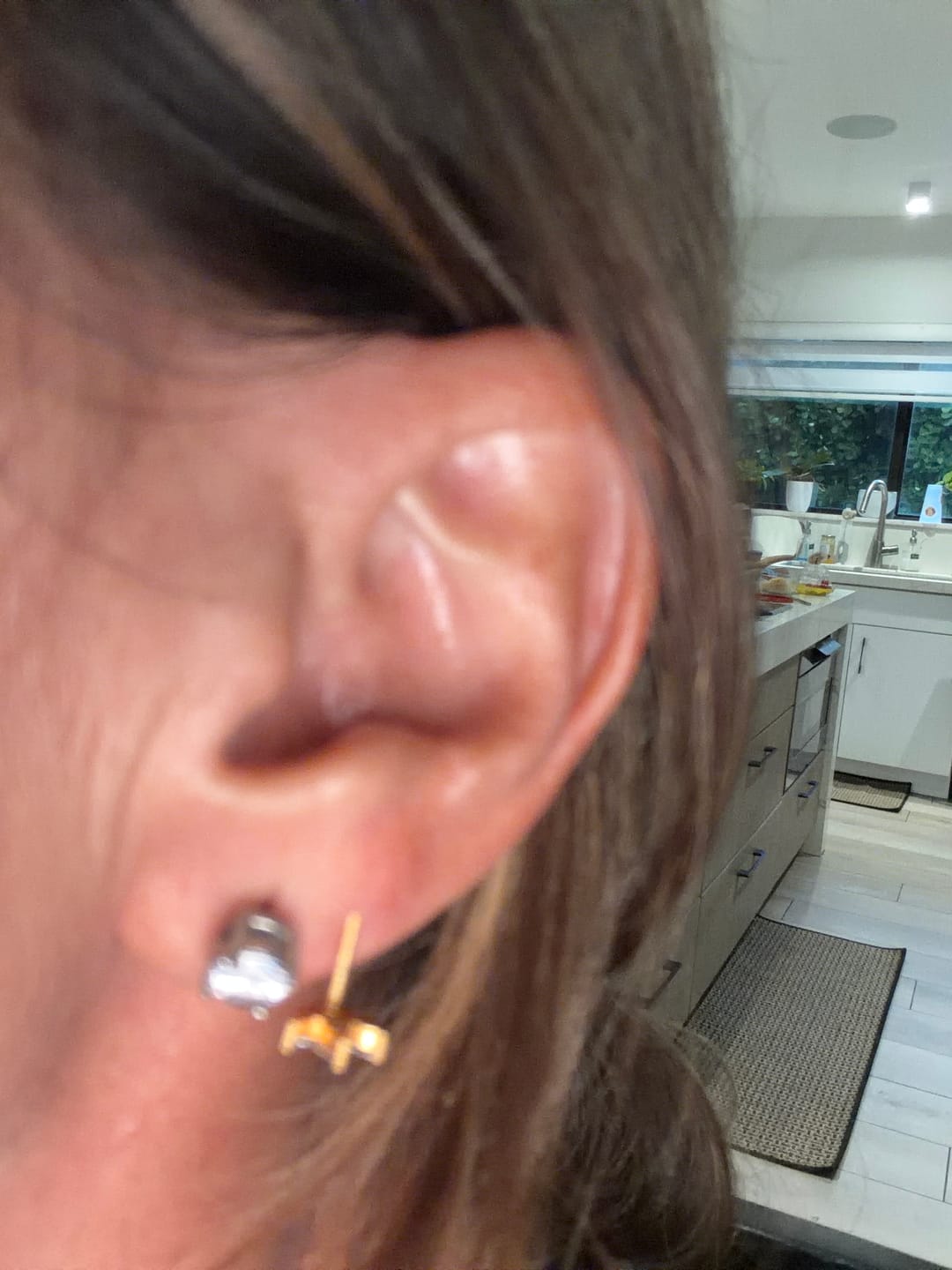 Customer photo review of Palm Fruit Comfort Earrings — Gold