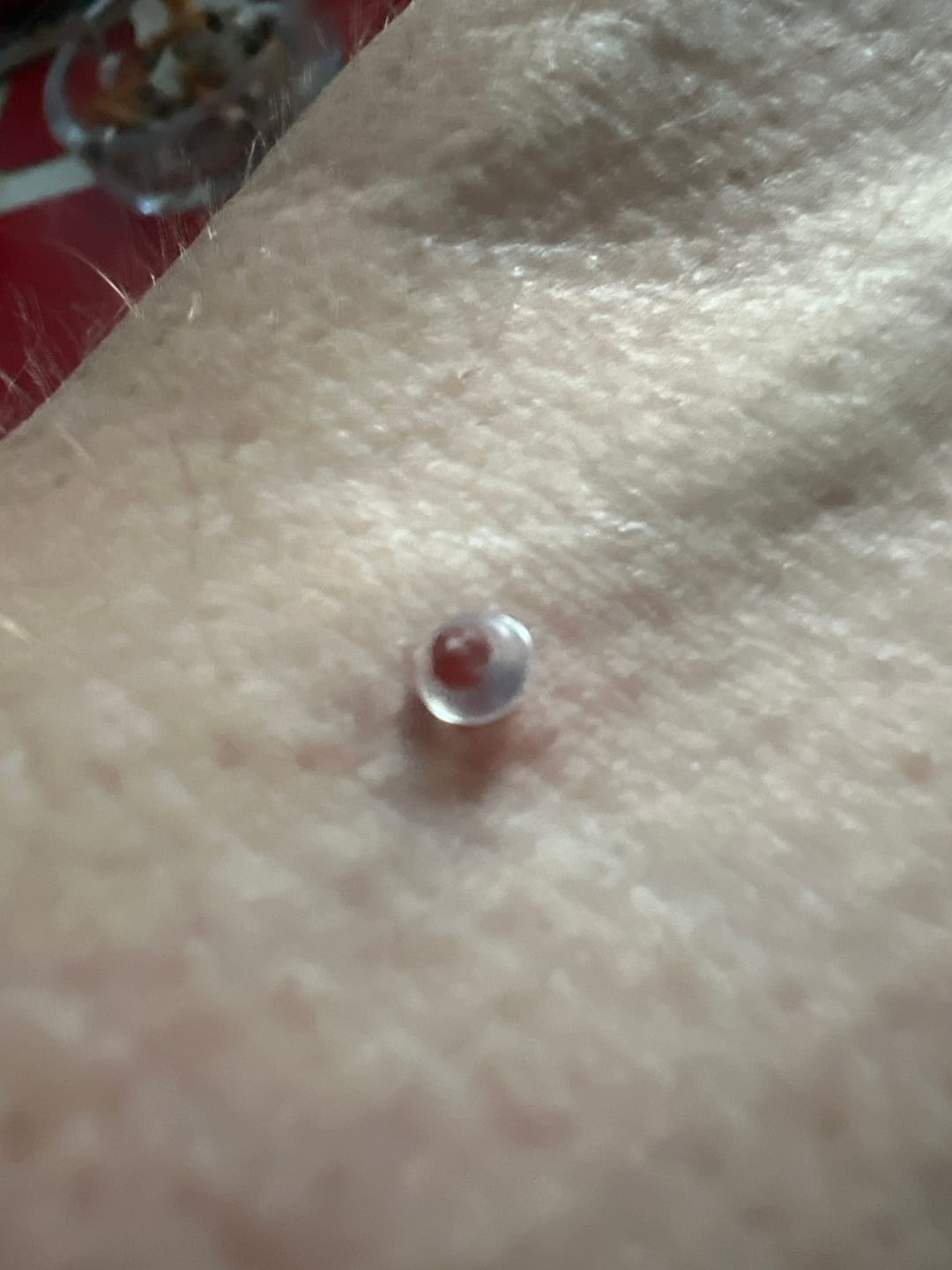 Customer photo review of Alcura Aftercare Patches