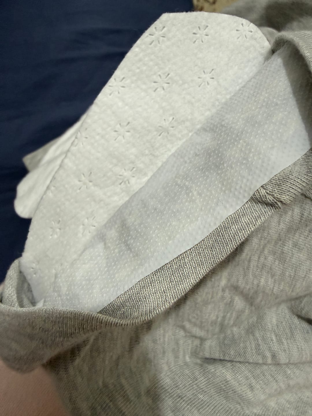 Customer photo review of פדים לבית השחי