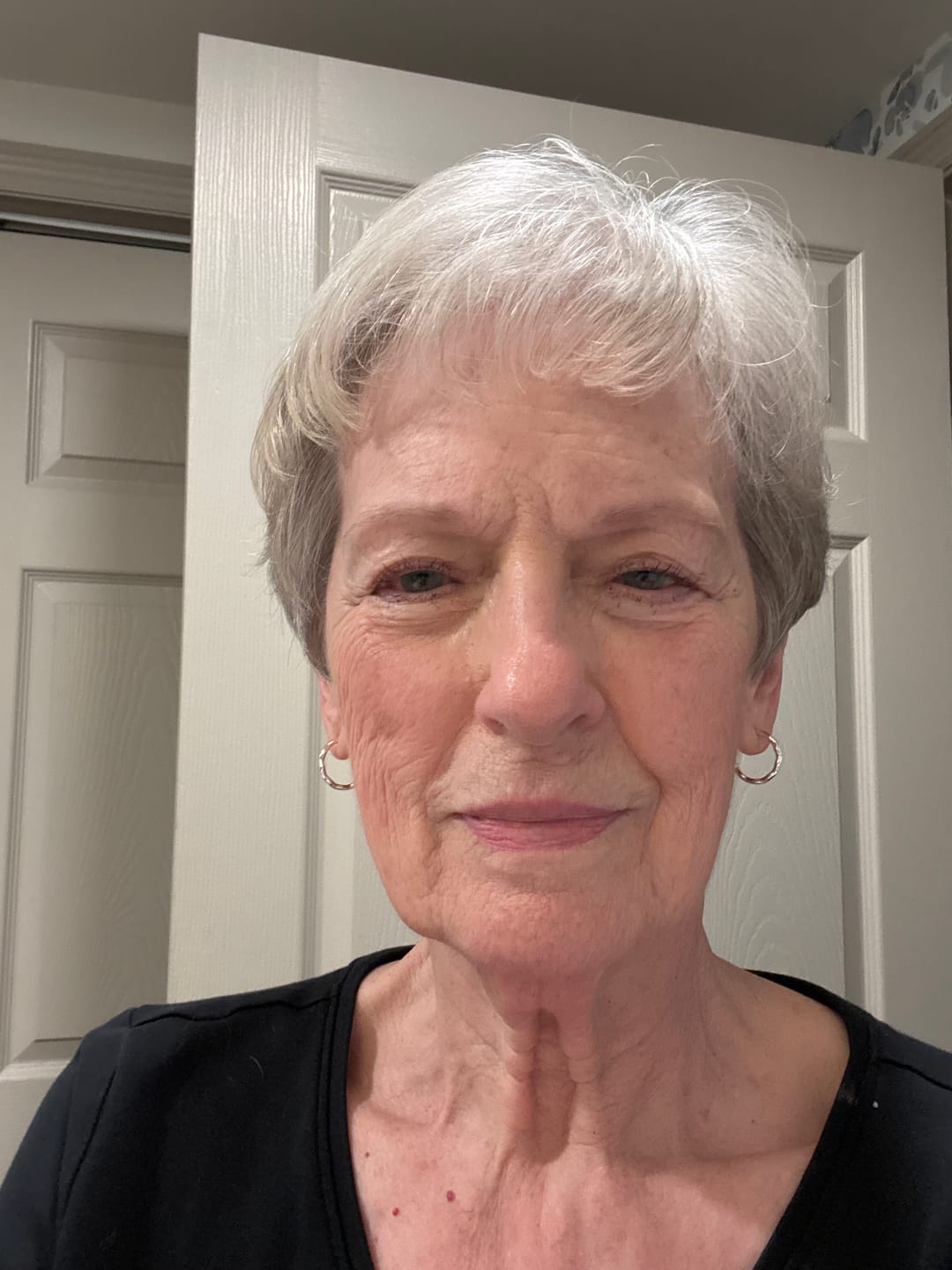Customer photo review of Koriderm™ Time Reverse Cream (All-In-One)