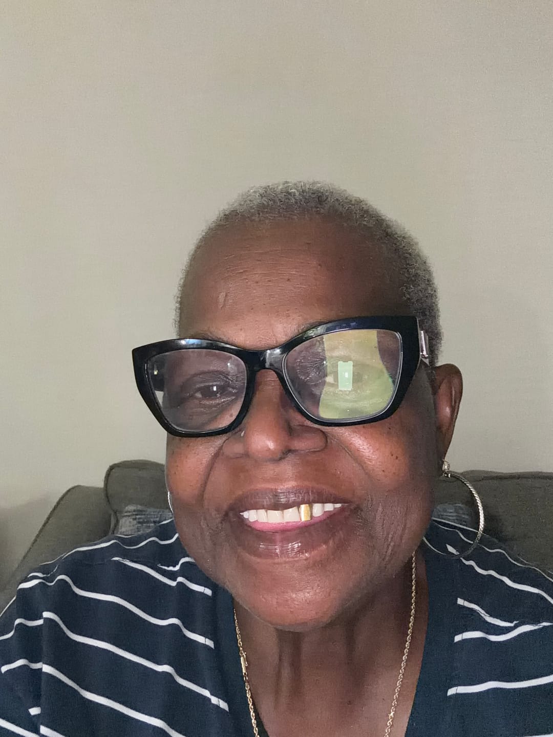 Customer photo review of JUMBO Scalp Stimulator