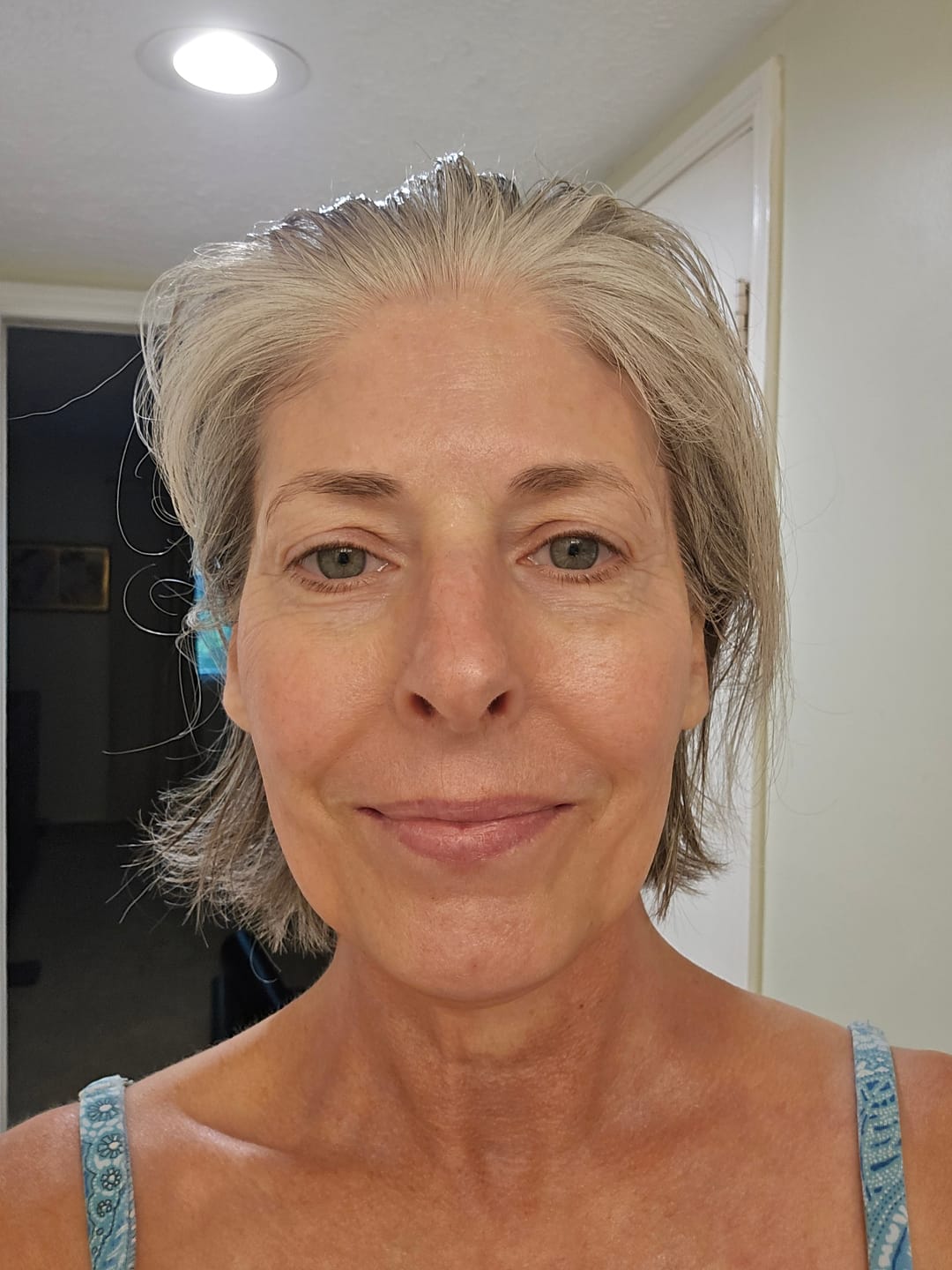 Customer photo review of The Micro Infusion System™