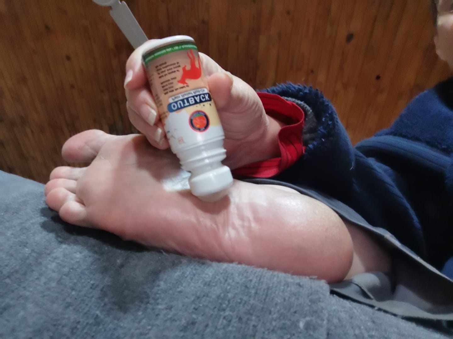 Customer photo review of Outback Pain Relief™ Oil 50ML Roll-On