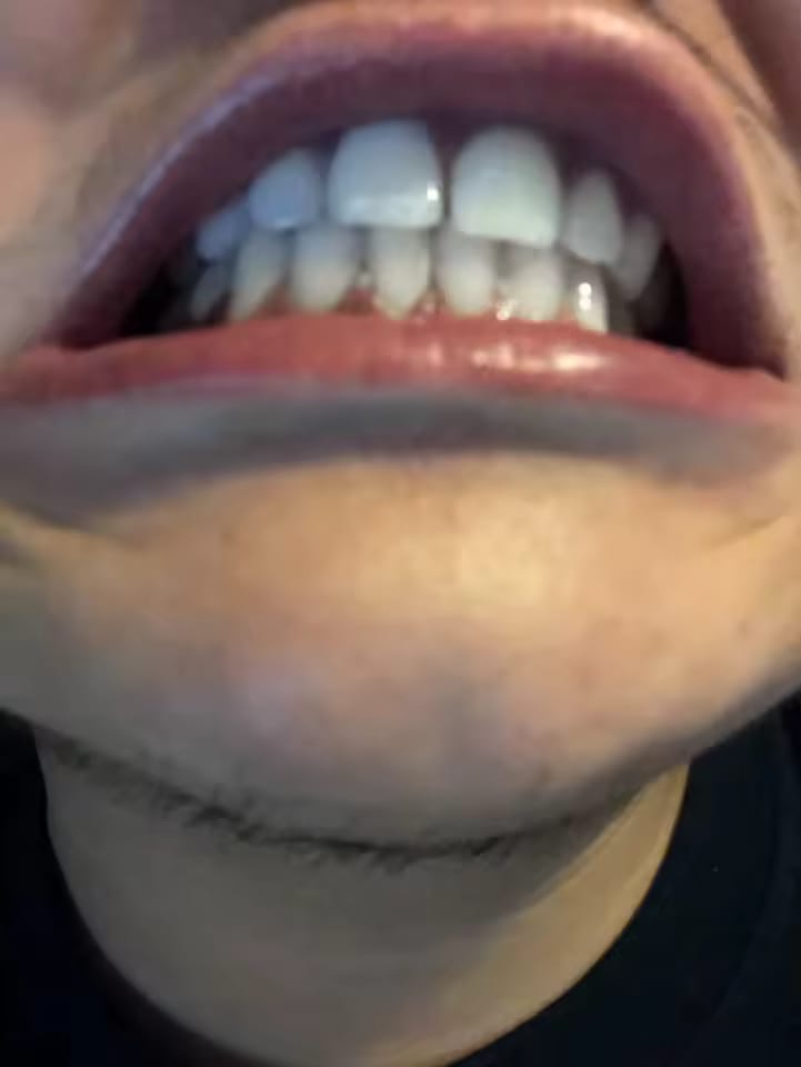 Customer photo review of SparkSmile - V34 (серум за избелване)