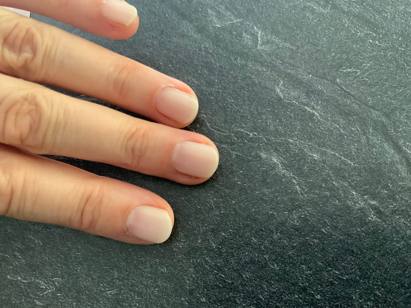 Customer photo review of UV Gel: Babyboomer Semi Transparent