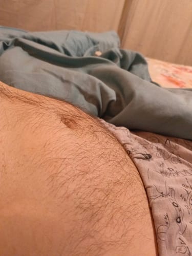Primer plano del abdomen de un cliente que utiliza Aesthetic RX20 para mostrar su progreso.