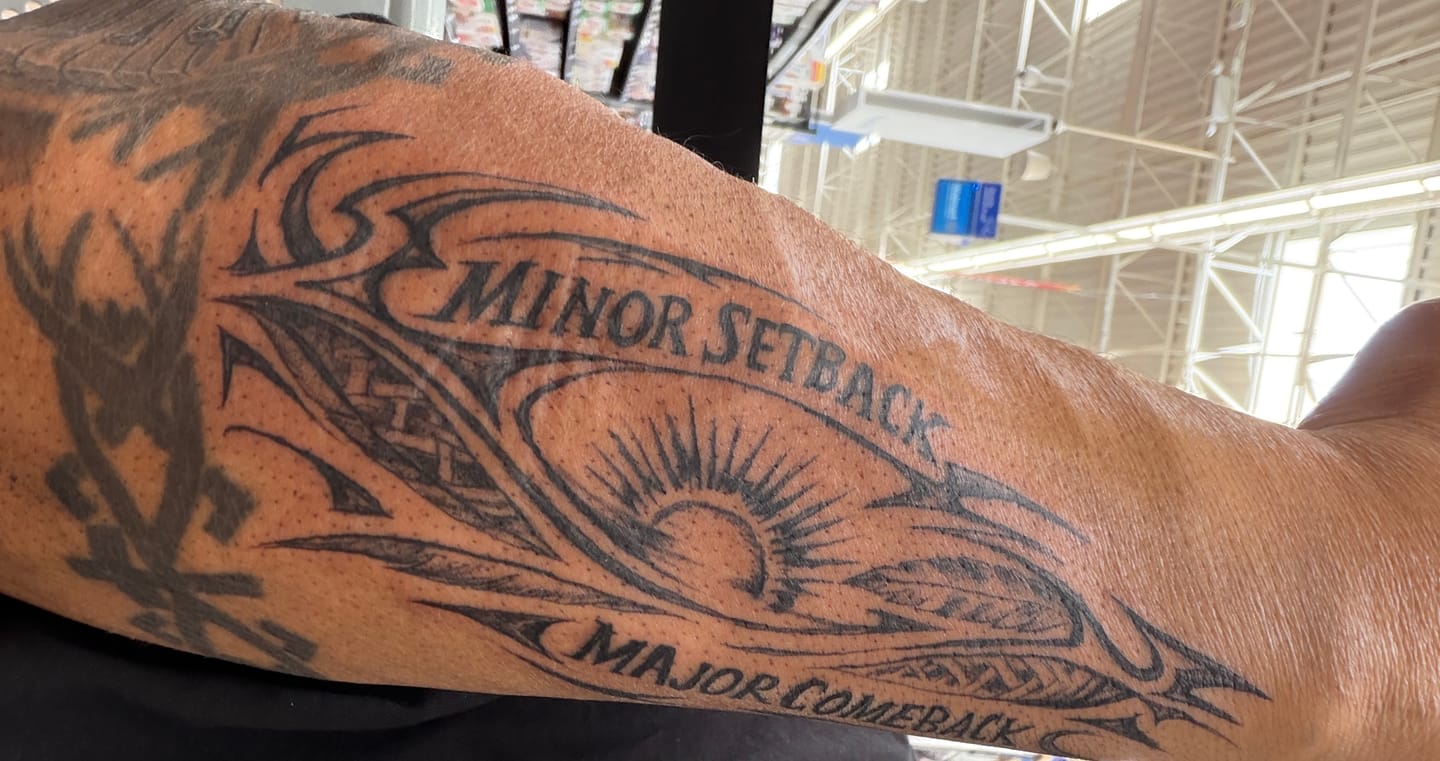 Customer photo review of Painless Tattoo 5 Pack